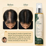 Hair Growth Oil For Man & Girls